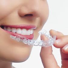 Điều trị bệnh nghiến răng như thế nào